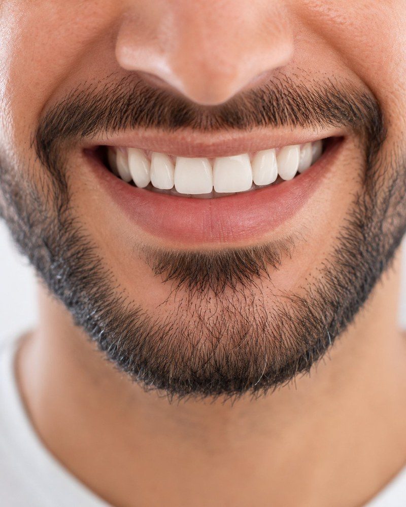 Aesthetic smile – FamDental Berlin Mitte